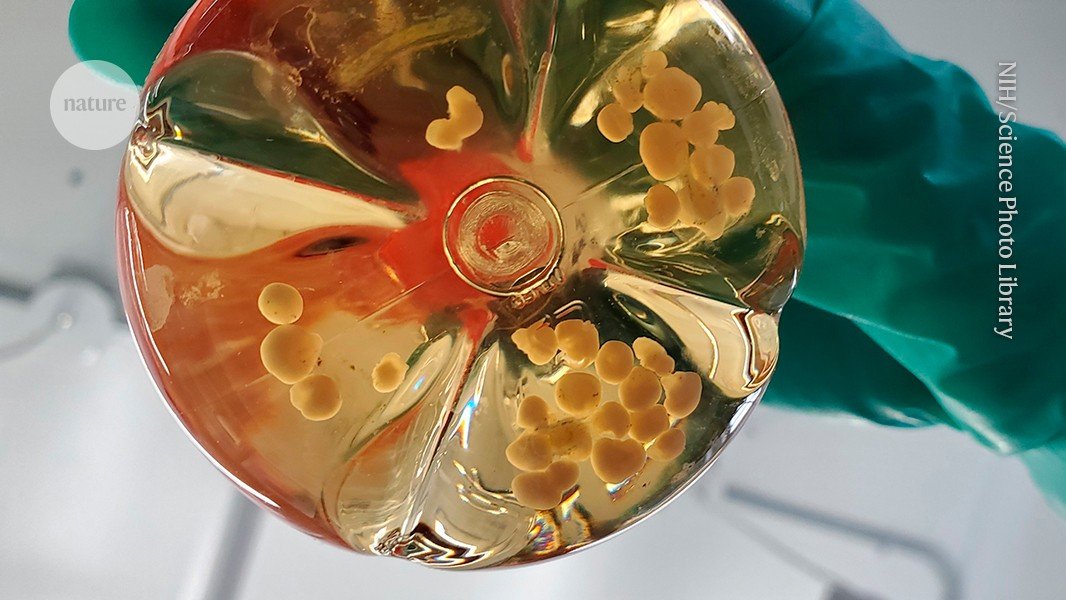 Researchers are building computers that run on brain organoids —