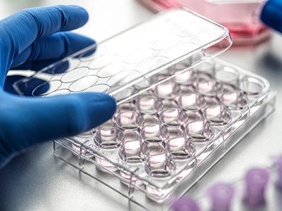 Researchers are building computers that run on brain organoids — but have neglected a major ethical issue 2 d41586 026 02316 8 26239370